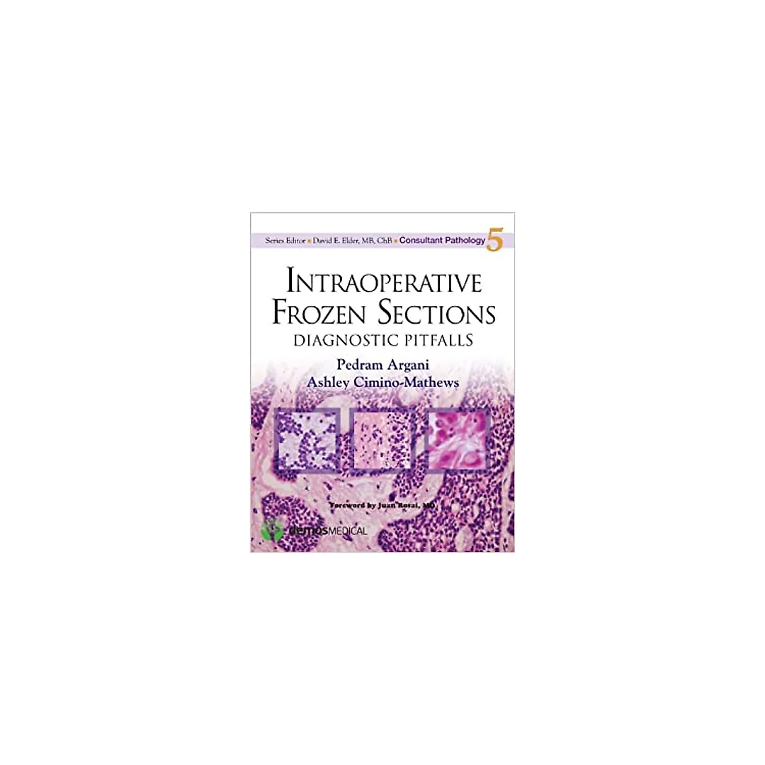 Intraoperative Frozen Sections: Diagnostic Pitfalls (Consultant Pathology Book 5)