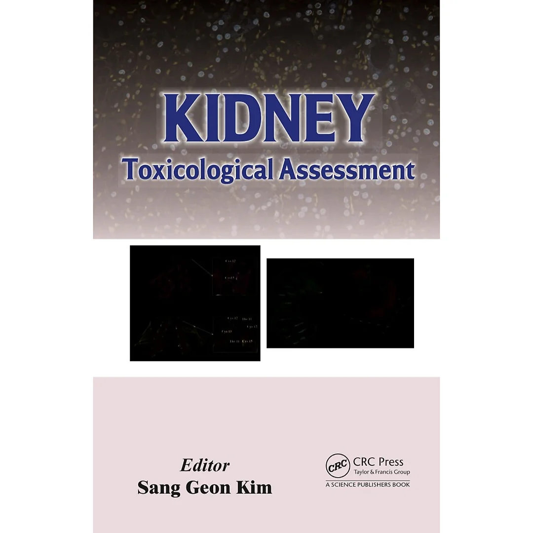 Kidney : Toxicological Assessment