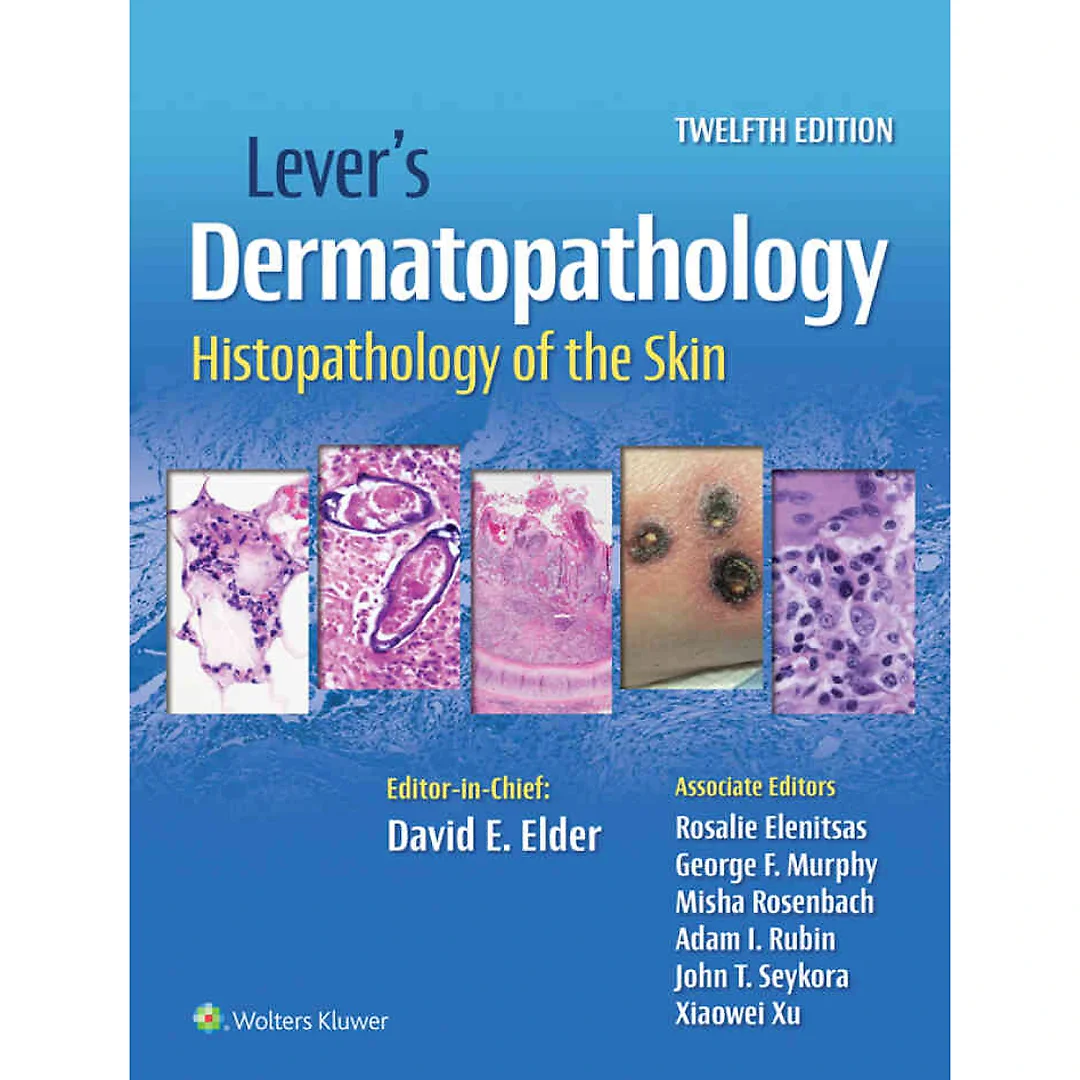 Lever's Dermatopathology Histopathology of the Skin