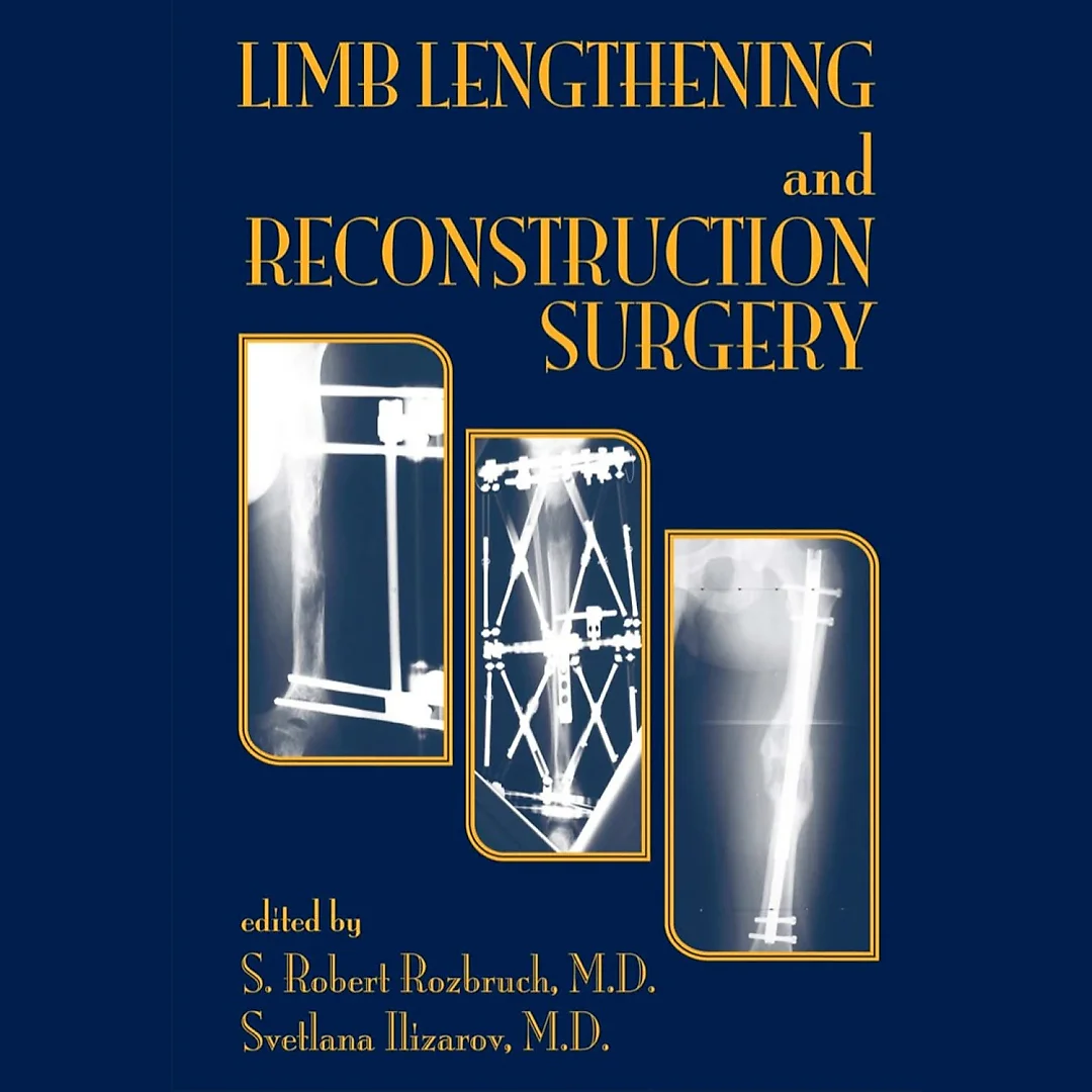 Limb Lengthening and Reconstruction Surgery
