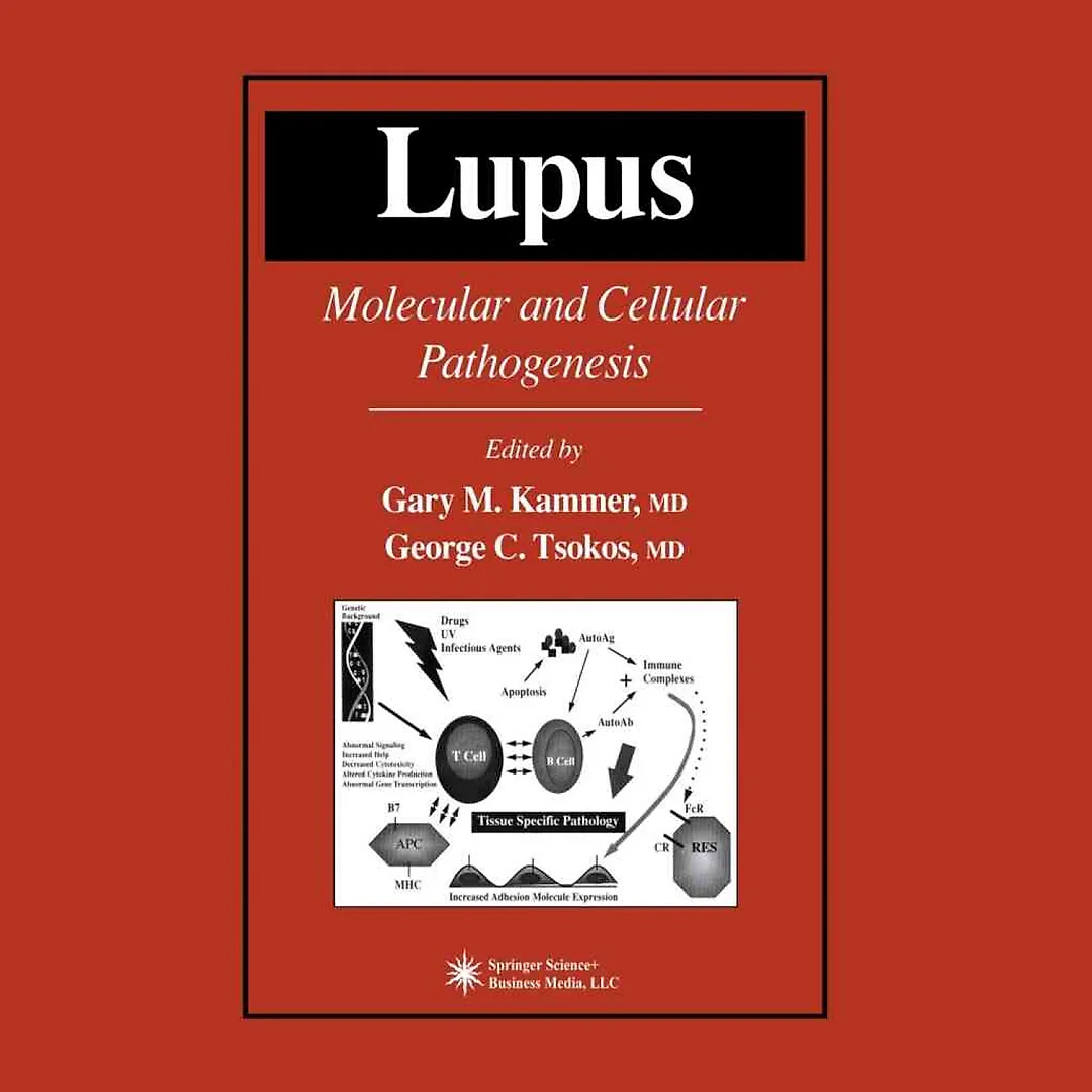 Lupus: Molecular and Cellular Pathogenesis