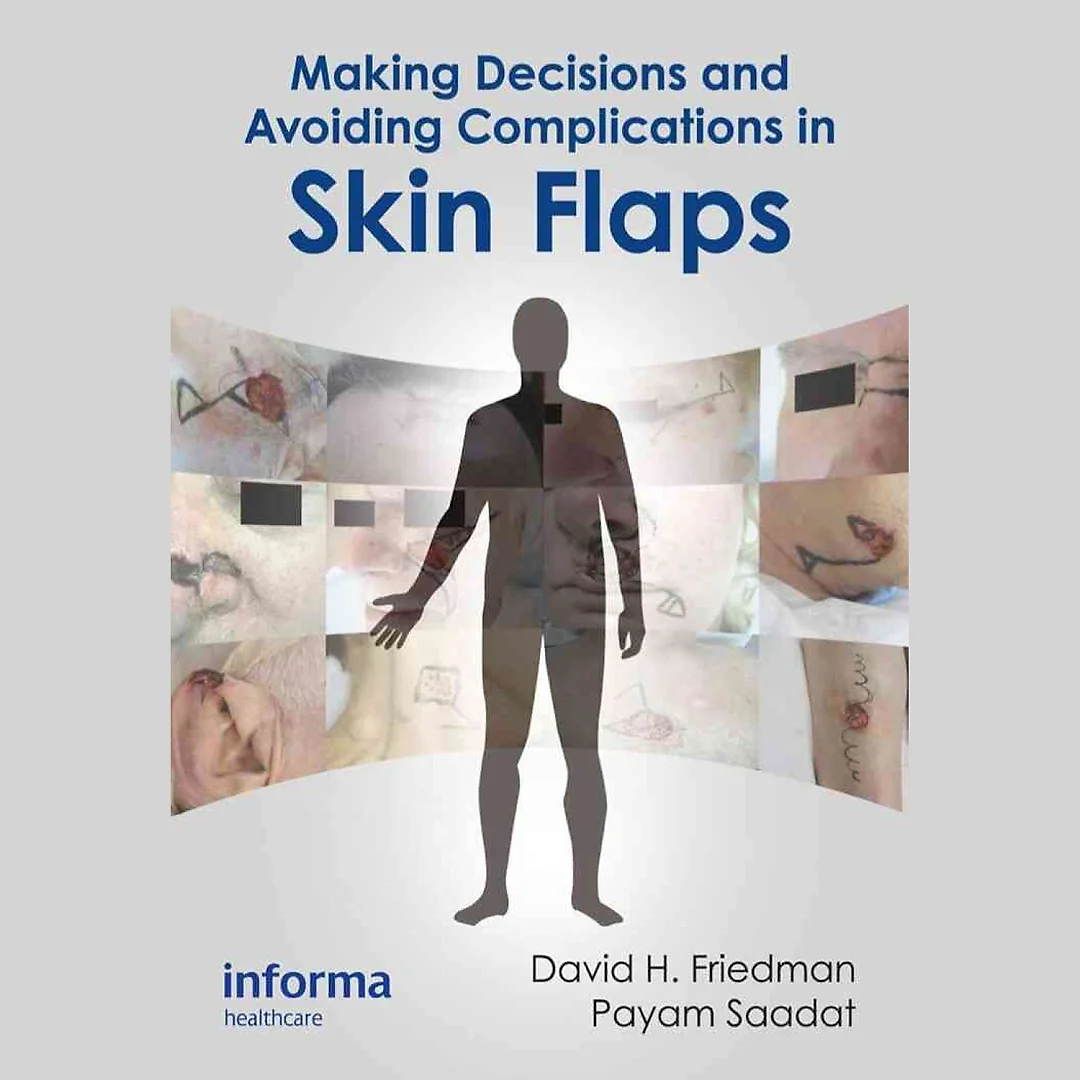 Making Decisions and Avoiding Complications in Skin Flaps