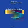 Male Genital Lesions: The Urological Perspective