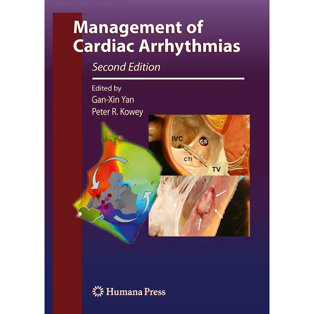 Management of Cardiac Arrhythmias