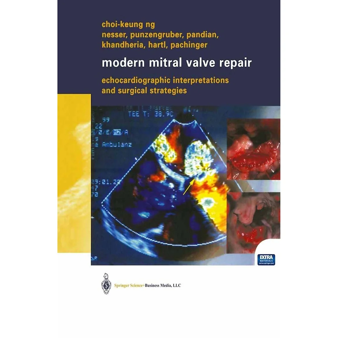 Modern Mitral Valve Repair: Echocardiographic Interpretations and Surgical Strategies