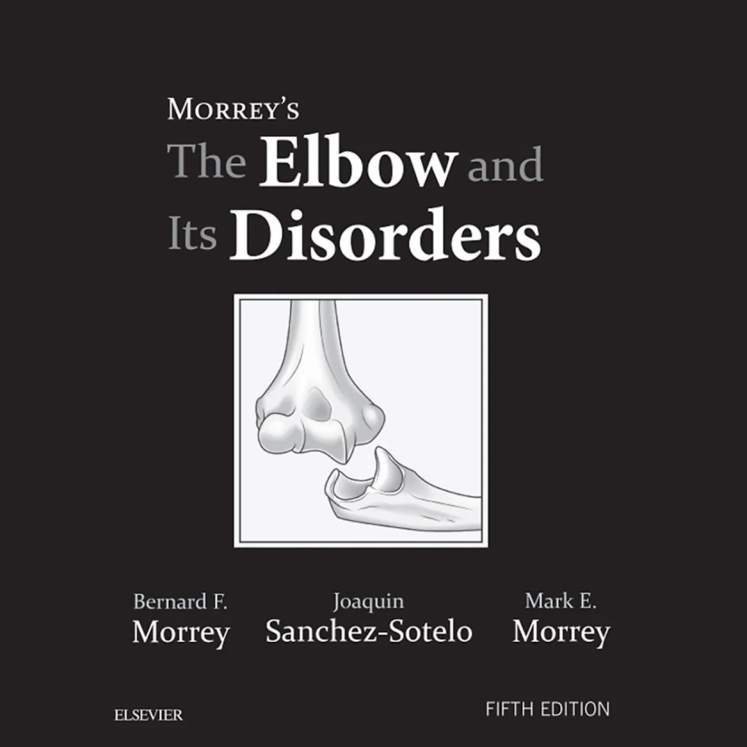 Morrey's The Elbow and Its Disorders