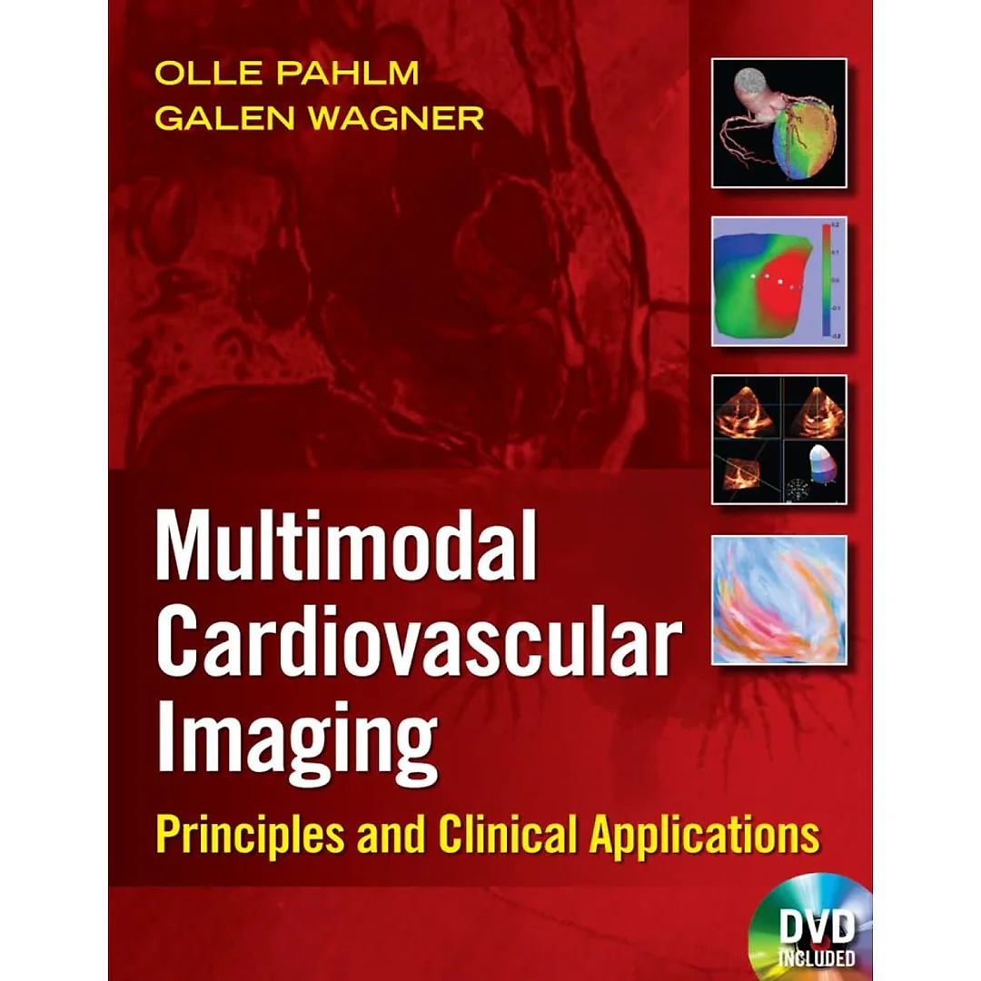 Multimodal Cardiovascular Imaging
