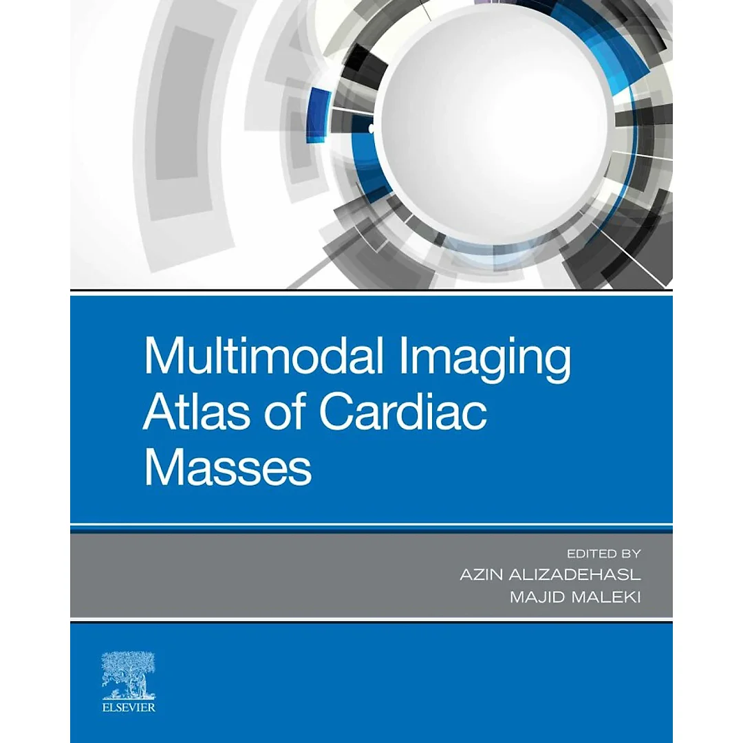 Multimodal Imaging Atlas of Cardiac Masses - E-Book