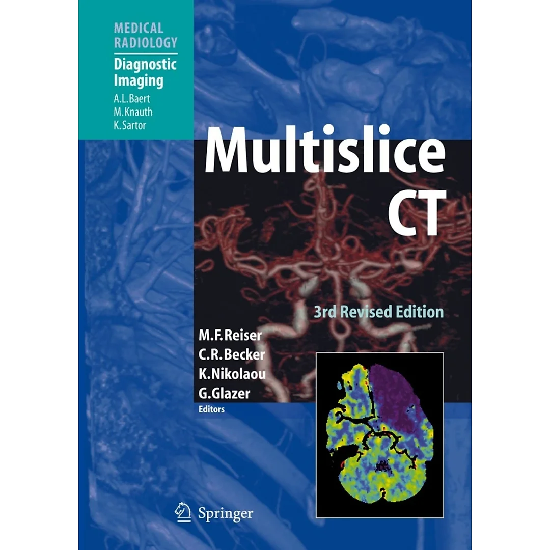 Multislice CT
