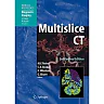 Multislice CT