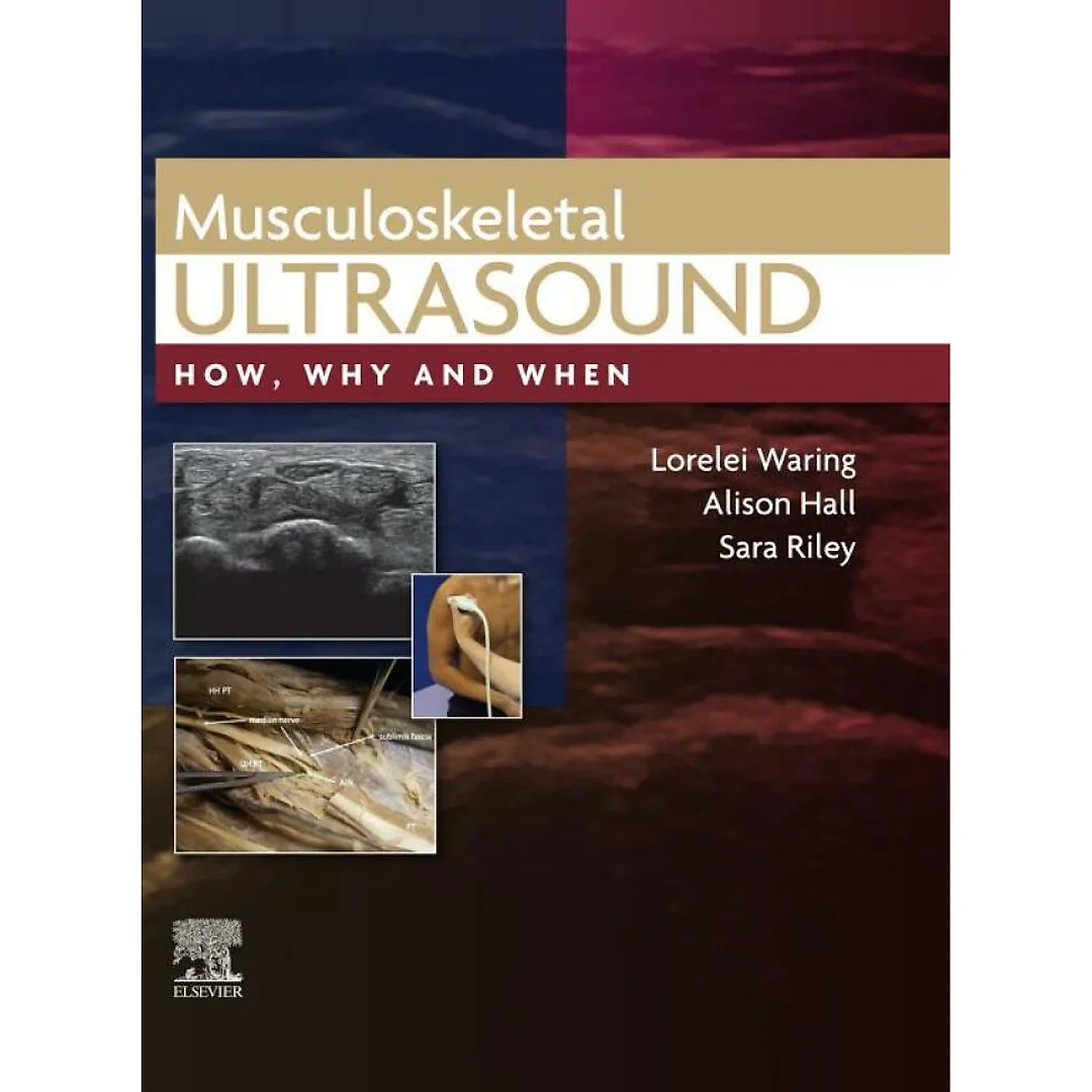 Musculoskeletal Ultrasound: How Why and When
