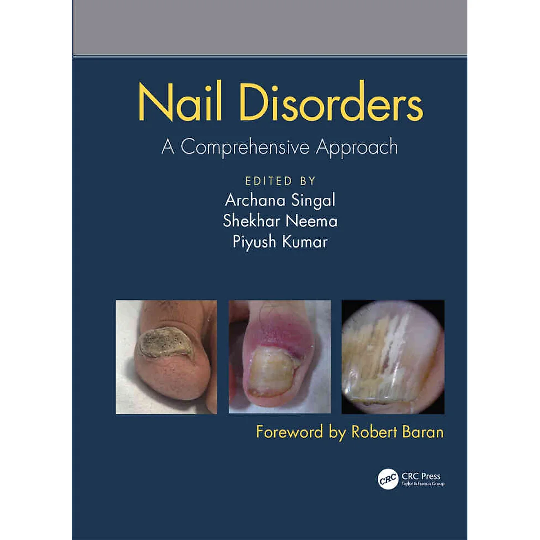 Nail Disorders: A Comprehensive Approach