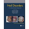 Nail Disorders: A Comprehensive Approach