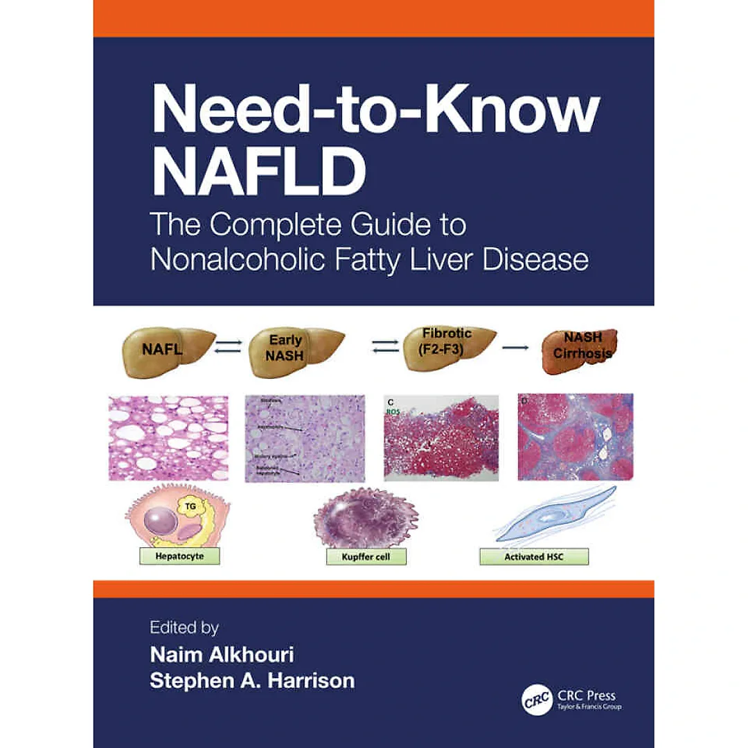 Need-to-Know NAFLD: The Complete Guide to Nonalcoholic Fatty Liver Disease