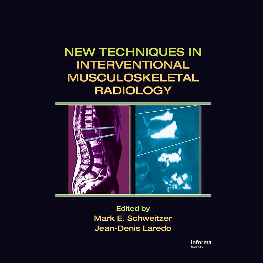 New Techniques in Interventional Musculoskeletal Radiology