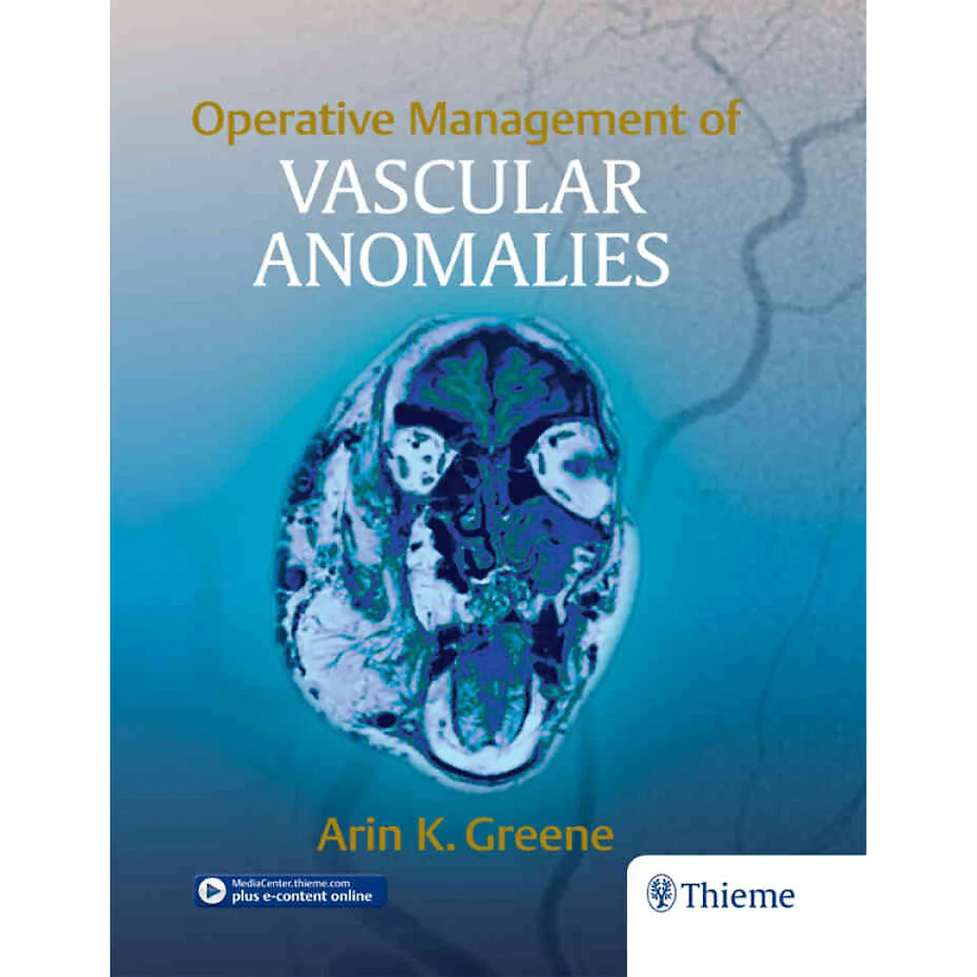 Operative Management of Vascular Anomalies