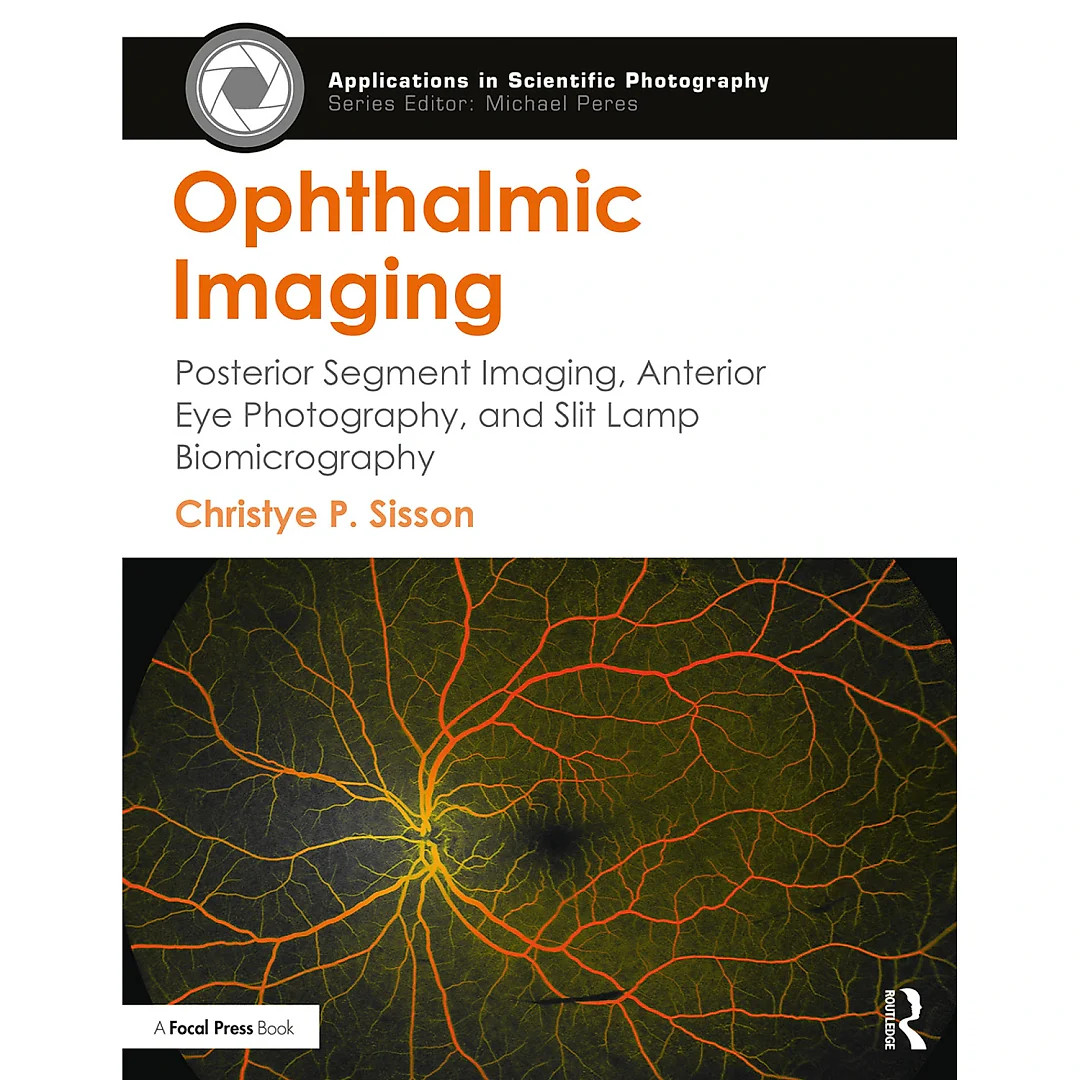 Ophthalmic Imaging: Posterior Segment Imaging, Anterior Eye Photography, and Slit Lamp Biomicrography