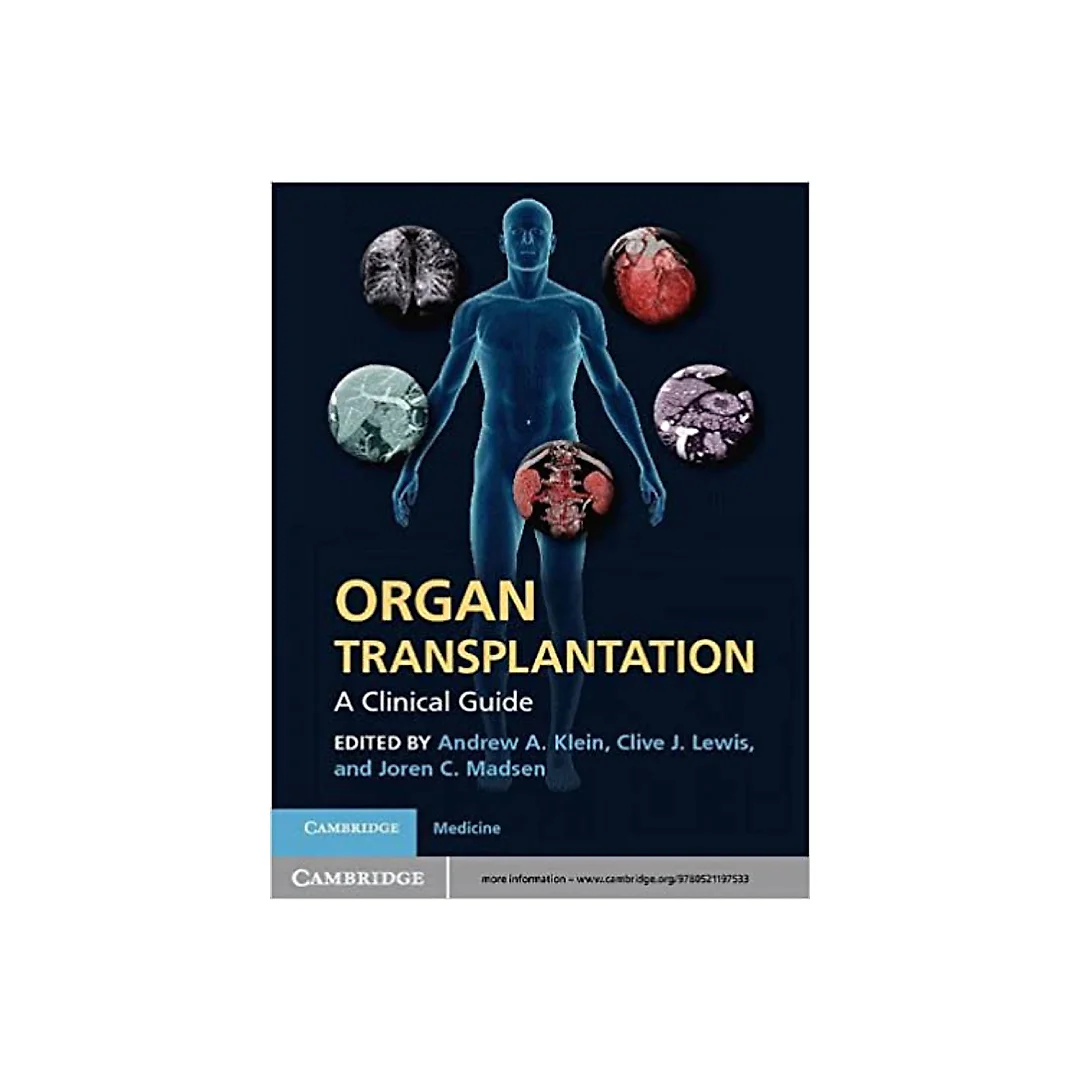 Organ Transplantation: A Clinical Guide