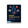 Organ Transplantation: A Clinical Guide