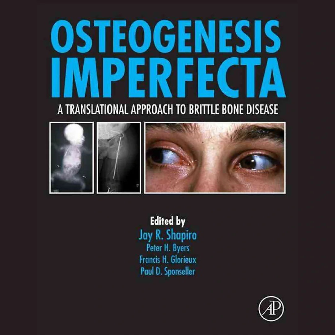 Osteogenesis Imperfecta: A Translational Approach to Brittle Bone Disease