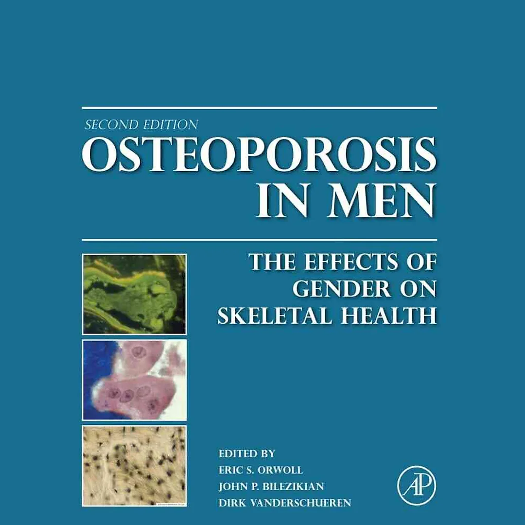 Osteoporosis in Men: The Effects of Gender on Skeletal Health