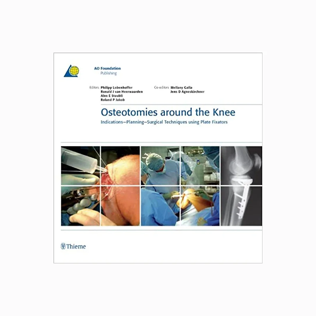 Osteotomies around the Knee: Indications-Planning-Surgical Techniques using Plate Fixators (AO-Publishing)