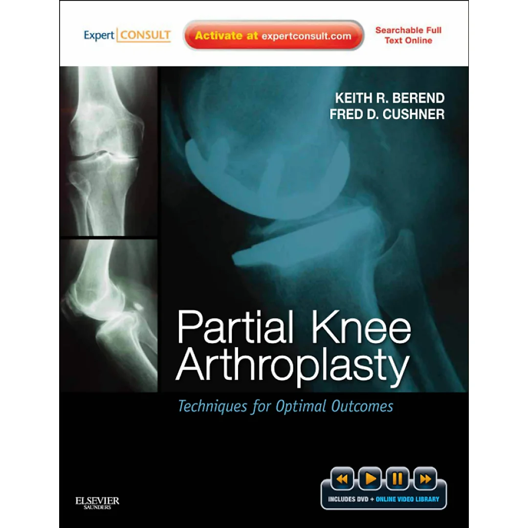 Partial Knee Arthroplasty