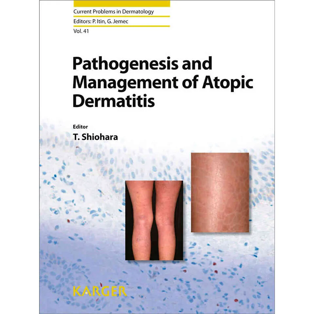 Pathogenesis and Management of Atopic Dermatitis