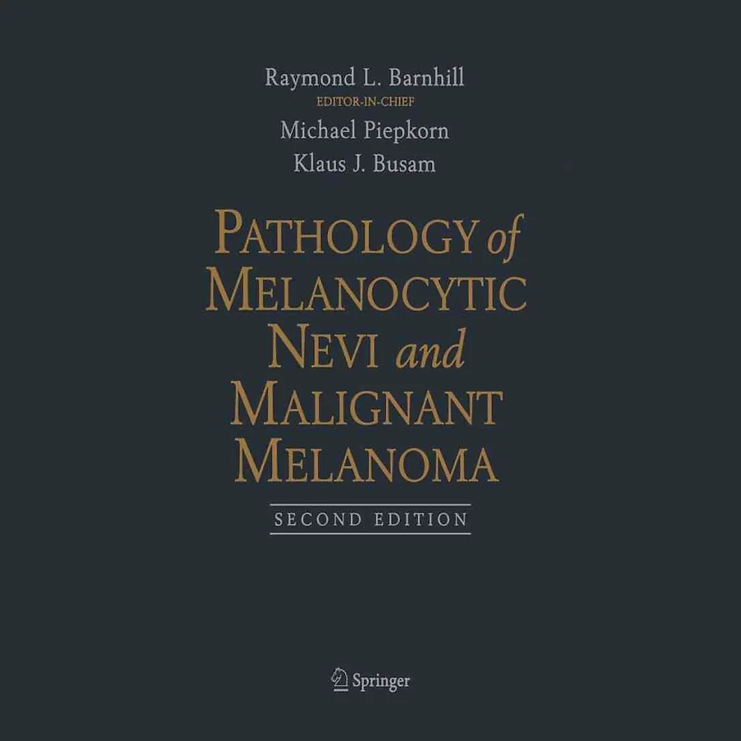 Pathology of Melanocytic Nevi and Malignant Melanoma