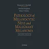 Pathology of Melanocytic Nevi and Malignant Melanoma