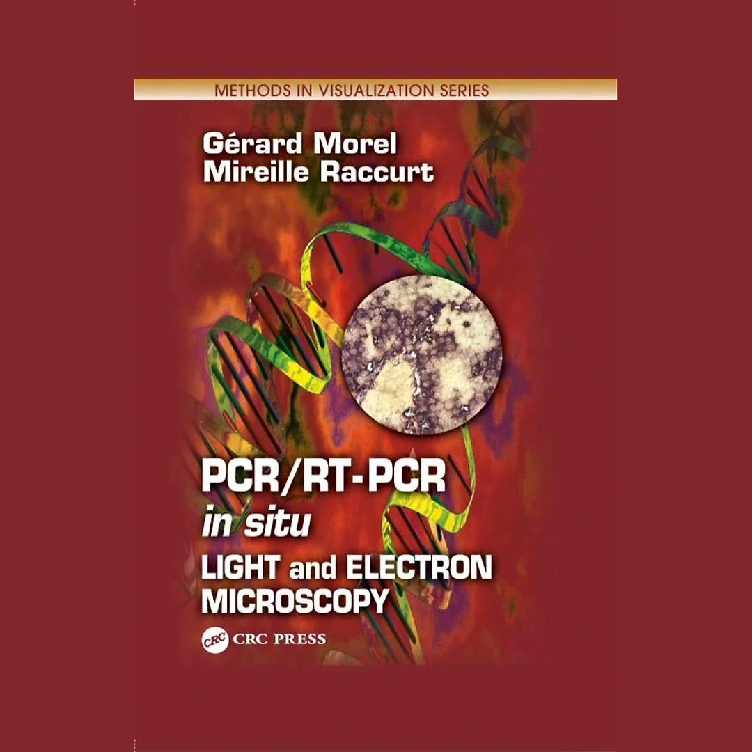 PCR/RT- PCR in situ: Light and Electron Microscopy