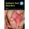 Pediatric Nail Disorders