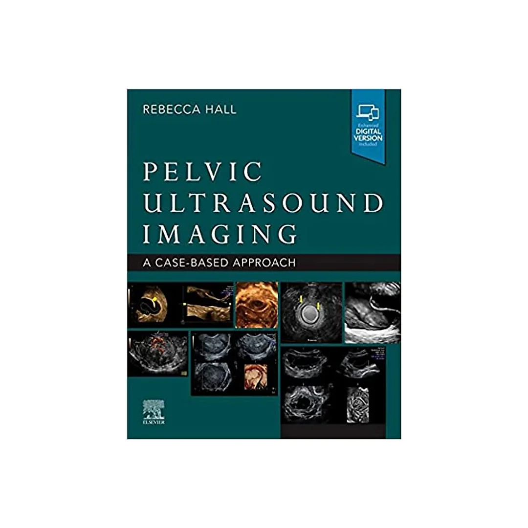 Pelvic Ultrasound Imaging, E-Book: A Cased-Based Application
