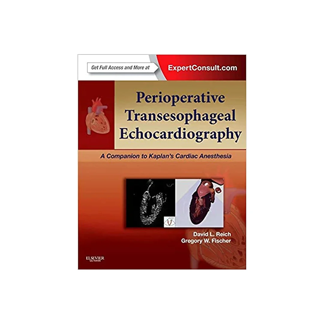 Perioperative Transesophageal Echocardiography: A Companion to Kaplan's Cardiac Anesthesia (Expert Consult: Online)