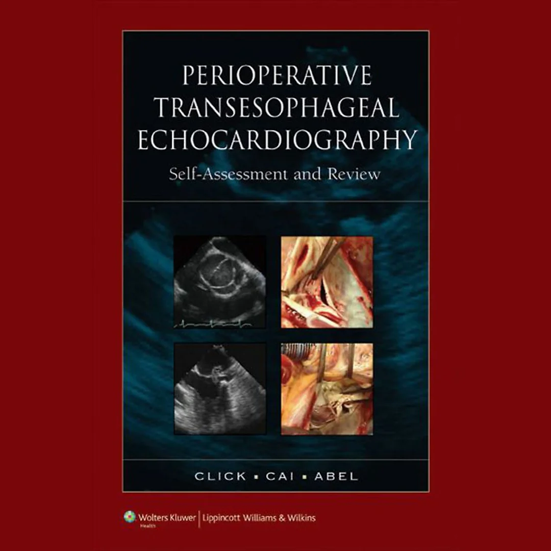 Perioperative Transesophageal Echocardiography Self-Assessment and Review