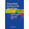 Periprosthetic Fractures of the Hip and Knee: Surgical Techniques and Tips