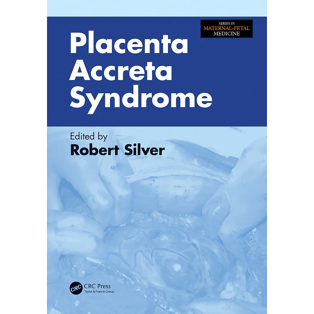 Placenta Accreta Syndrome