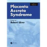 Placenta Accreta Syndrome