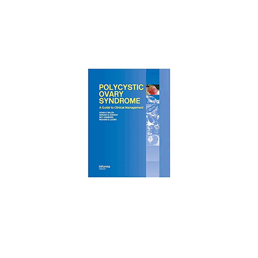 Polycystic Ovary Syndrome: A Guide to Clinical Management