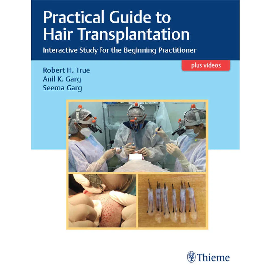 Practical Guide to Hair Transplantation: Interactive Study for the Beginning Practitioner