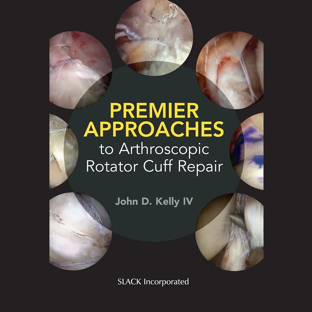 Premier Approaches to Arthroscopic Rotator Cuff Repair