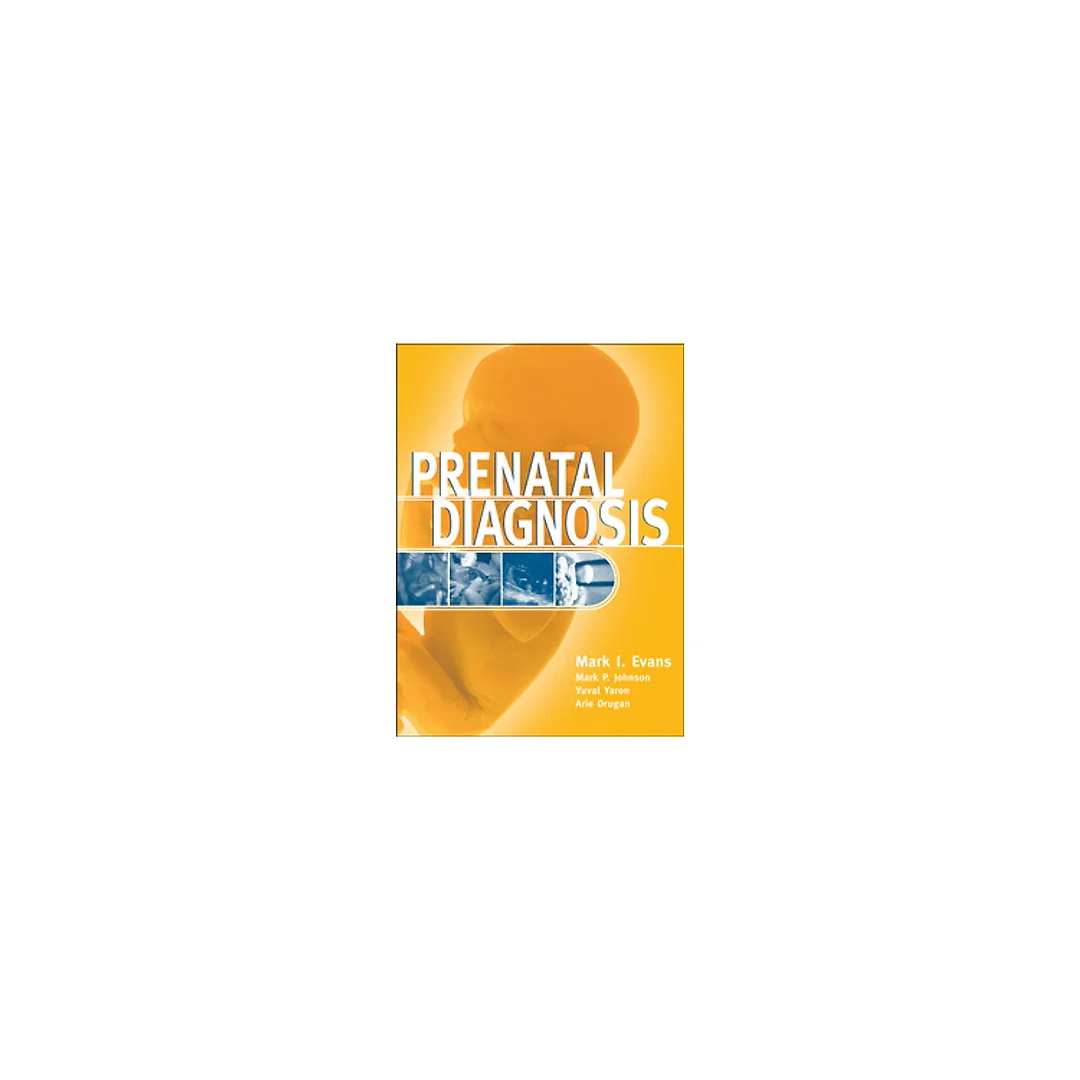 Prenatal Diagnosis