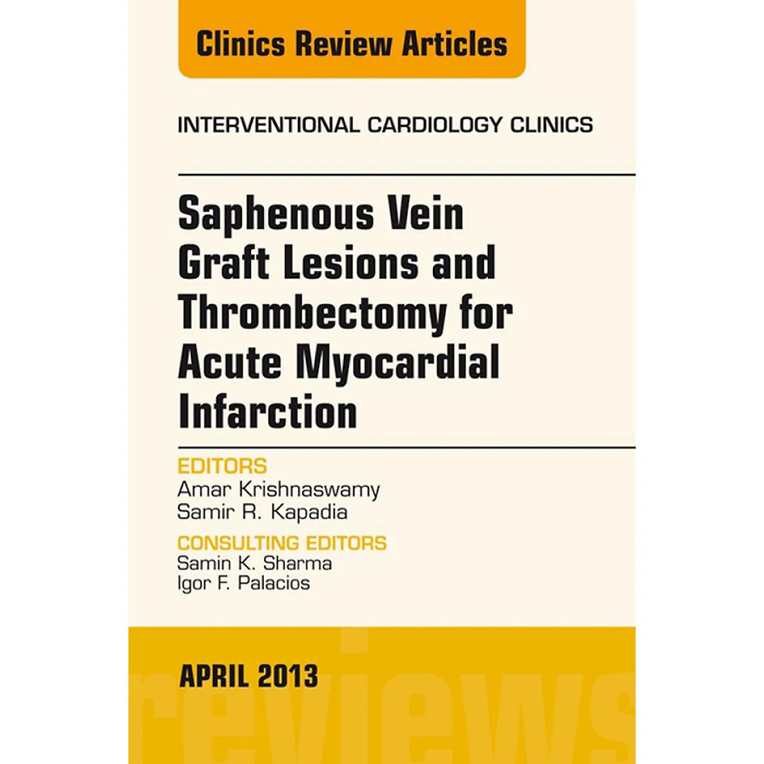 Saphenous Vein Graft Lesions and Thrombectomy for Acute Myocardial Infarction, An Issue of Interventional Cardiology Clinics