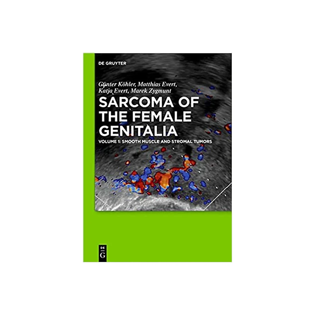 Smooth muscle and stromal tumors and prevention of inadequate surgery