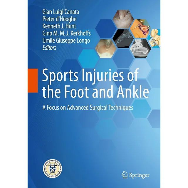 Sports Injuries of the Foot and Ankle: A Focus on Advanced Surgical Techniques