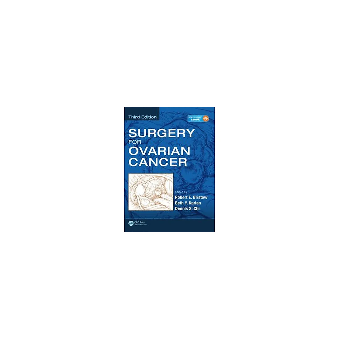 Surgery for Ovarian Cancer