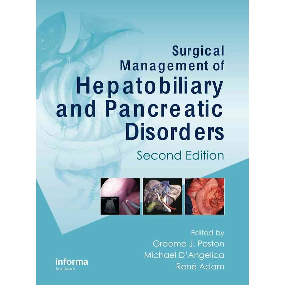 Surgical Management of Hepatobiliary and Pancreatic Disorders