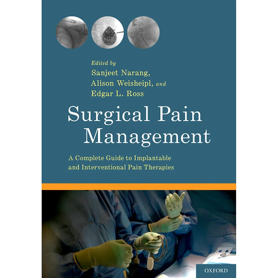 Surgical Pain Management: A Complete Guide to Implantable and Interventional Pain Therapies