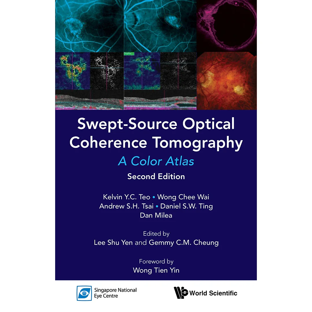 SWEPT-SOURCE OPTICAL COHERENCE TOMOGRAPHY: A COLOR ATLAS (SECOND EDITION)A Color Atlas