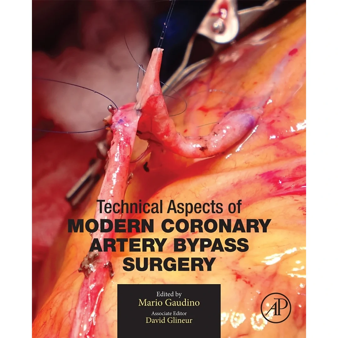 Technical Aspects of Modern Coronary Artery Bypass Surgery